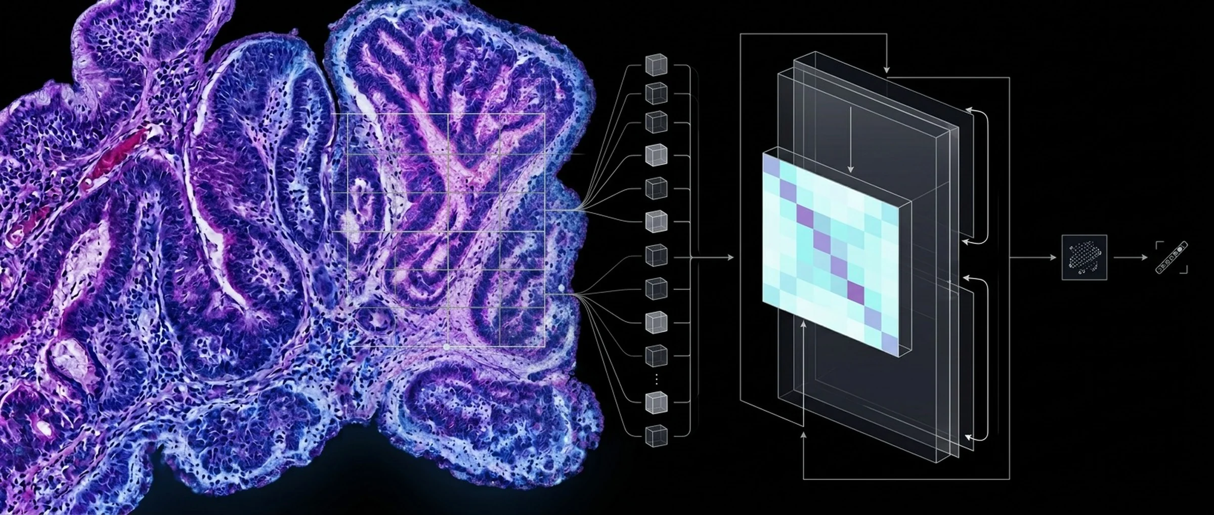 A stained tissue section overlaid with a sampling grid, its patches fed as tokens into a stack of model layers that produce a matrix of learned features and, from it, a compact prediction.