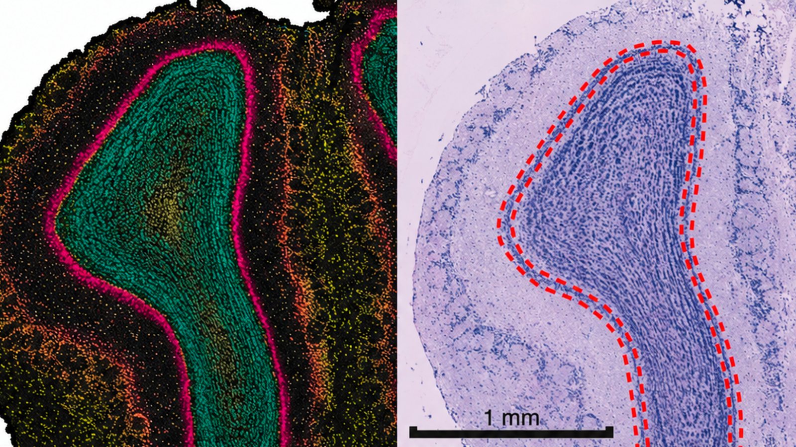A spatial gene-expression map of a tissue section beside the matching stained histology section, with the corresponding region outlined in red.