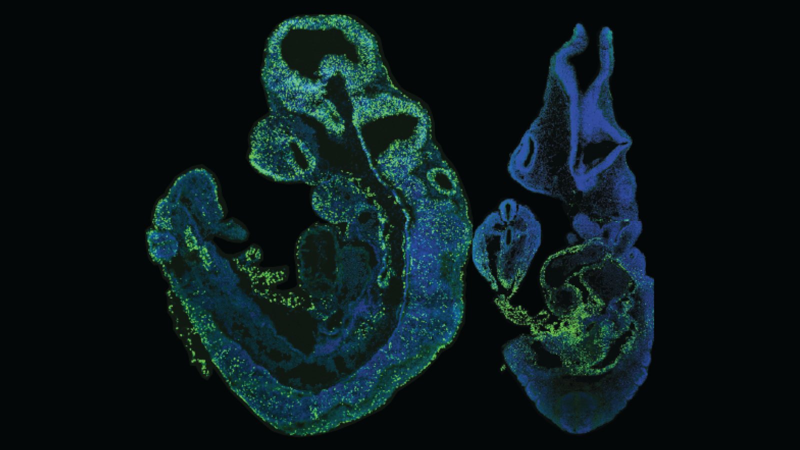 Sections of two mouse embryos on black, with nuclei in blue and virus-labelled cells in green spread through the developing nervous system.