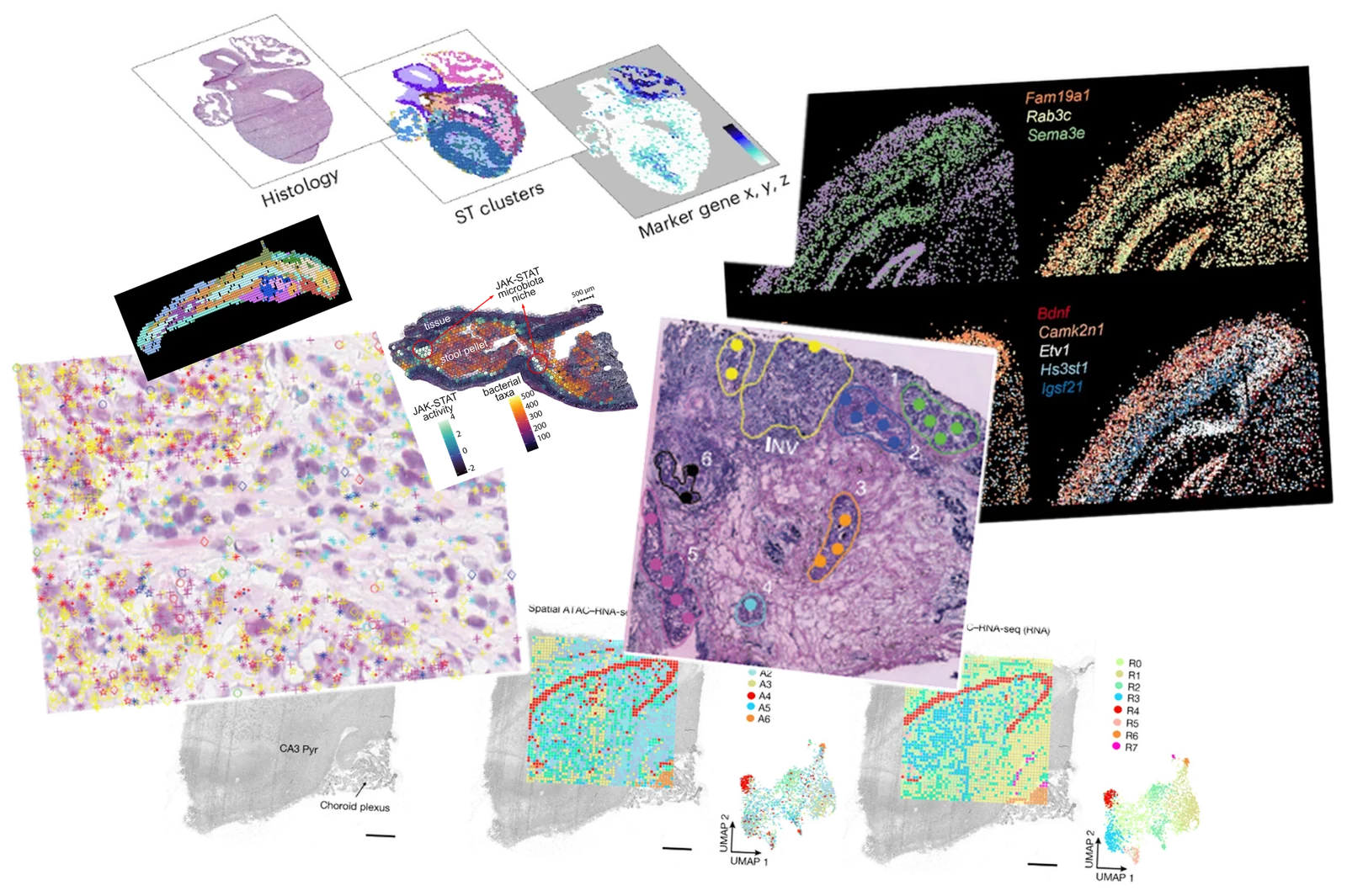 Collage of spatial biology results: histology sections, spatial transcriptomics clusters, multiplexed gene-expression maps of brain tissue, and a gut section mapping bacterial taxa against host JAK-STAT activity.